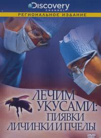 Discovery: Лечим укусами. Пиявки, личинки и пчелы/Leeches, Maggots and Bees: The Bite that Cures (2000)