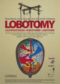 Лоботомия/Lobotomiya (2010)